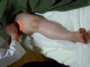 健康快復センター江南のキャビテーションで美脚施術。太ももの画像