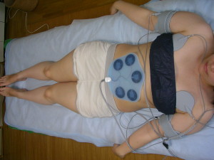 ボディセラプロ（ＥＭＳ）によるお腹、二の腕の引き締めとバストアップ